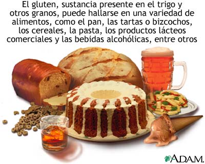 Esprúe celíaco; alimentos que se deben evitar