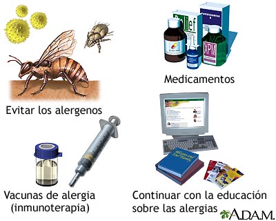 Introducción al tratamiento de las alergias
