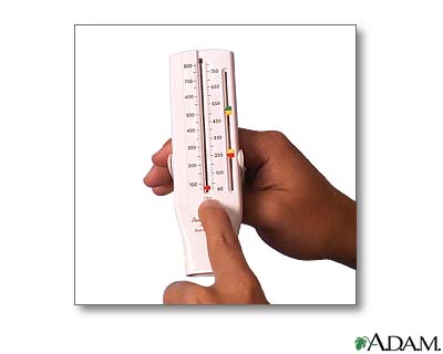 Uso del medidor de flujo espiratorio m&aacute;ximo (Segunda parte)