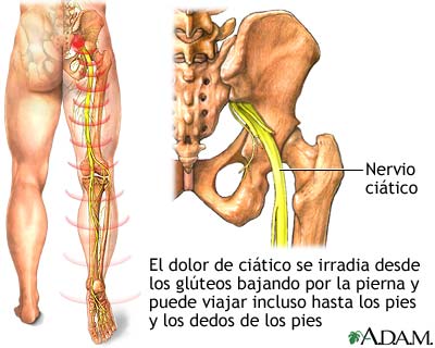 Nervio ciático