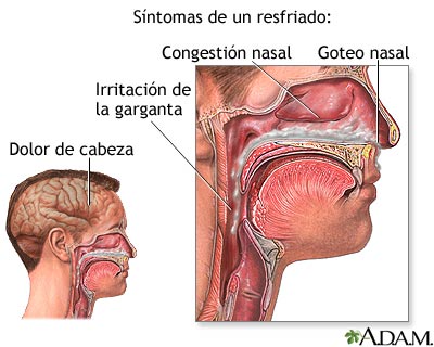 Síntomas del resfriado