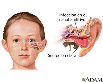 O&iacute;do de nadador