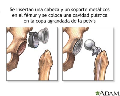 Procedimiento (segunda parte)