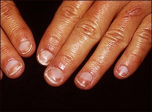 Uñas mitad y mitad