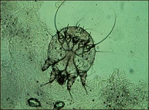 Microfotografía del ácaro de la escabiosis