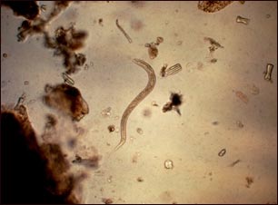 Anquilostoma larva rabditiforme