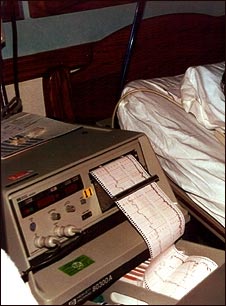 Monitor cardíaco fetal y de contracción uterina