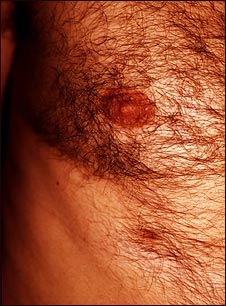 Pez&oacute;n supernumerario