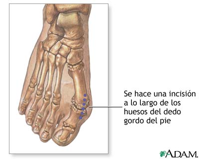 Procedimiento (primera parte)