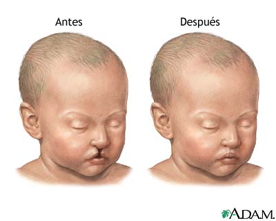 Cuidados postoperatorios