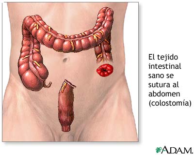 Procedimiento (segunda parte)