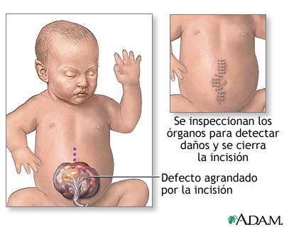 Procedimiento