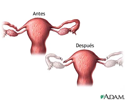 Cuidados postoperatorios