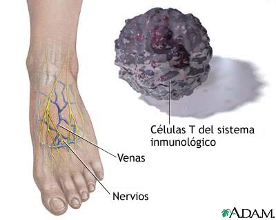 Cuidado de los pies del diab&eacute;tico