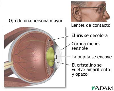 Anatomía de un ojo envejecido