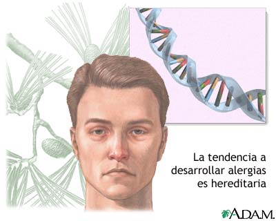 Alergias