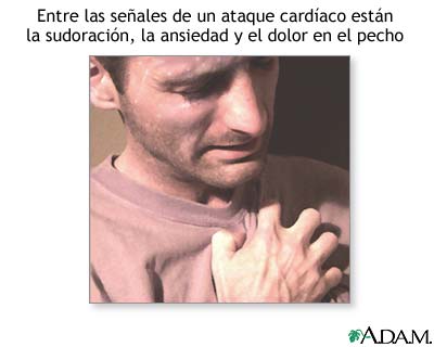 Síntomas de un ataque cardíaco
