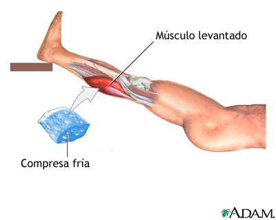 Tratamiento para distensión de la rodilla