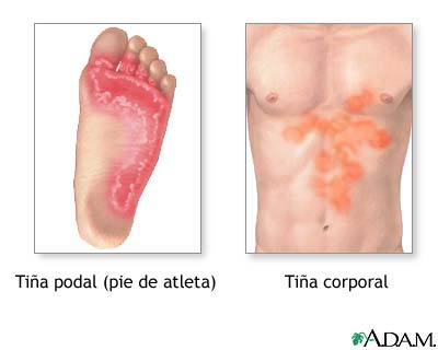 Tia