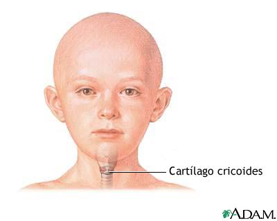 Cartílago cricoides