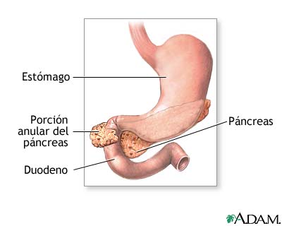 P&aacute;ncreas anular