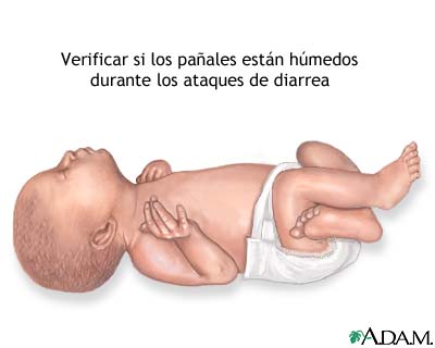 Diarrea y pañales