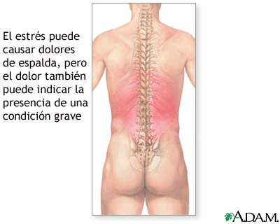 Dolores de espalda