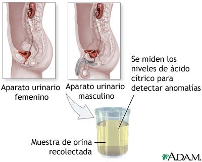 Prueba del ácido cítrico en la orina