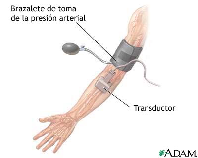 Examen de ultrasonido Dúplex/doppler