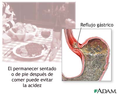 Prevención de la acedía