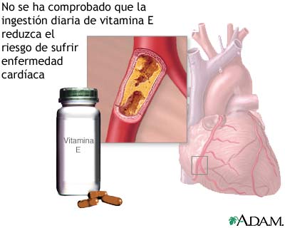 Vitamina E y la enfermedad cardíaca