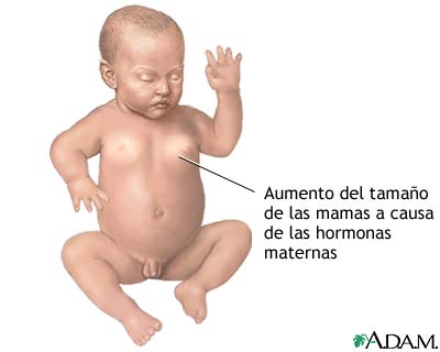 Efectos hormonales en los reci&eacute;n nacidos