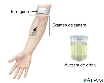 Niveles hormonales