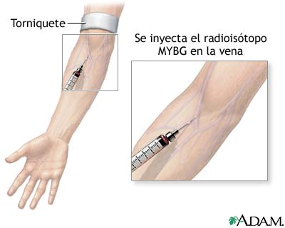 Inyección de MIBG