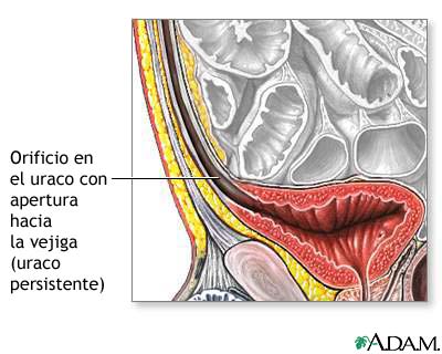 Uraco permeable