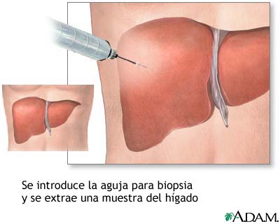 Cultivo de tejido hep&aacute;tico