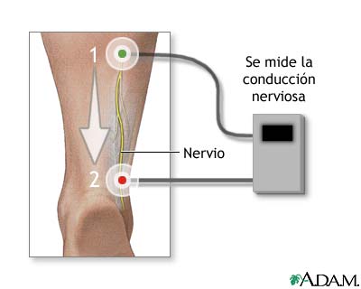 Prueba de conducción nerviosa