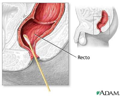 Cultivo rectal