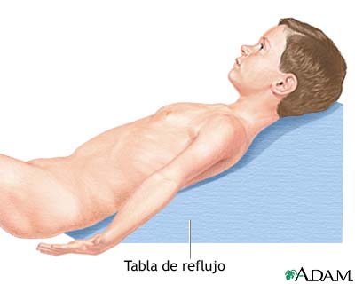 Tablero de reflujo