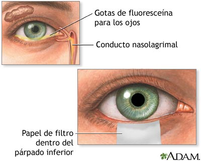 Examen de Shirmers