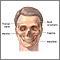Reconstrucción cráneofacial - Serie