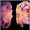 Tuberculosis renal