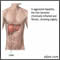 Hepatitis agresiva