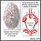 Aneurisma cerebral