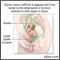 Peligros del cáncer de ovario