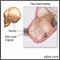 Moldeamiento de la cabeza fetal