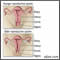 Menopausia