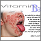 Déficit de vitamina B3