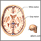 Materia gris y blanca del cerebro