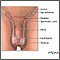 Reparación quirúrgica de la torsión testicular - Serie